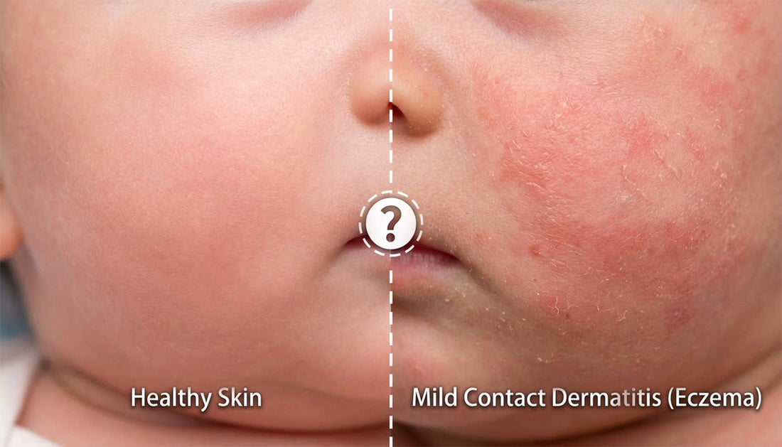 The Ultimate Guide to Allergy-Free Baby Skin: How to Prevent Newborn Skin Allergies Before They Start